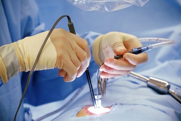 minimally-invasive-cardiac-surgery